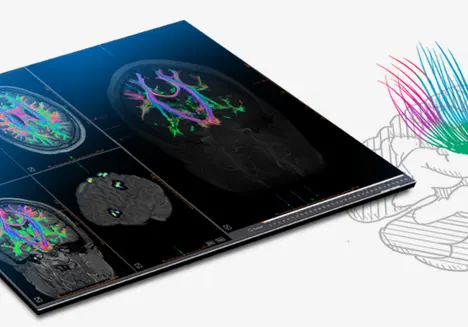 olea-mri